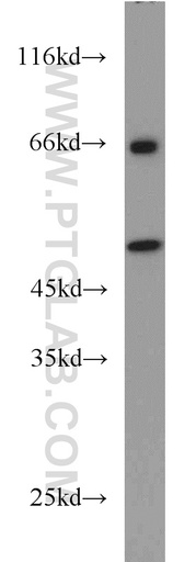 [14532-1-AP-150UL] RELT Polyclonal antibody