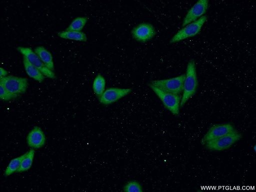 [14533-1-AP-150UL] LAMR1,RPSA Polyclonal antibody