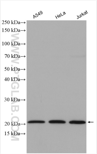 [14536-1-AP-150UL] RPL12 Polyclonal antibody