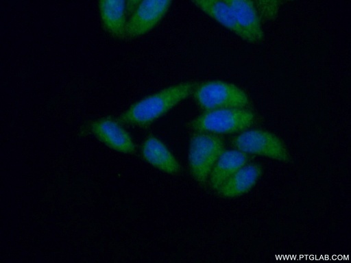 [14540-1-AP-150UL] MLL5 Polyclonal antibody