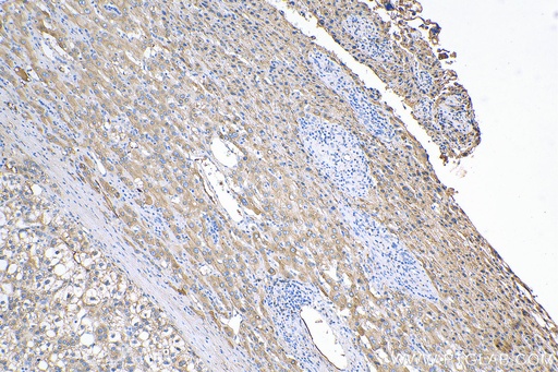 [14554-1-AP-20UL] C1S Polyclonal antibody