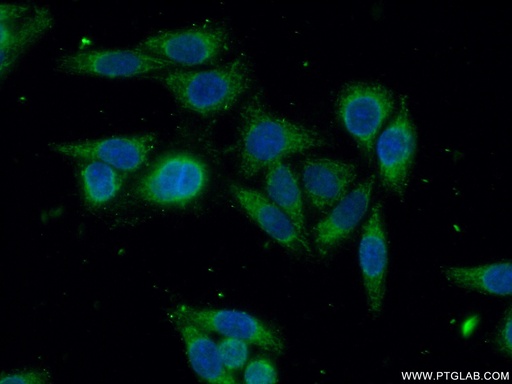 [14562-1-AP-150UL] GSTO2 Polyclonal antibody