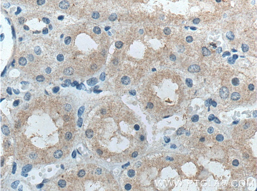 [14570-1-AP-20UL] FBXO27 Polyclonal antibody
