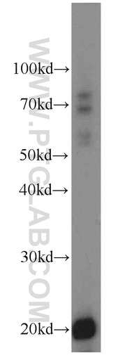 [14571-1-AP-150UL] TMEM27 Polyclonal antibody