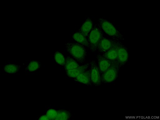 [14597-1-AP-20UL] HMGB2 Polyclonal antibody