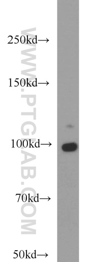 [14605-1-AP-150UL] DNM2 Polyclonal antibody