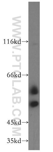 [14606-1-AP-150UL] TCP11 Polyclonal antibody