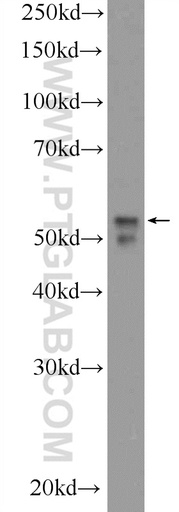 [14610-1-AP-150UL] NEUROD4 Polyclonal antibody