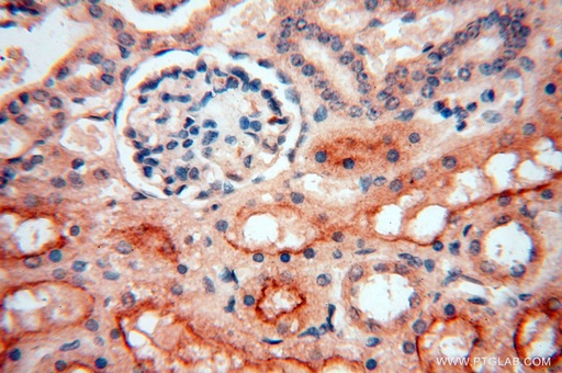 [14622-1-AP-150UL] AKAP14 Polyclonal antibody
