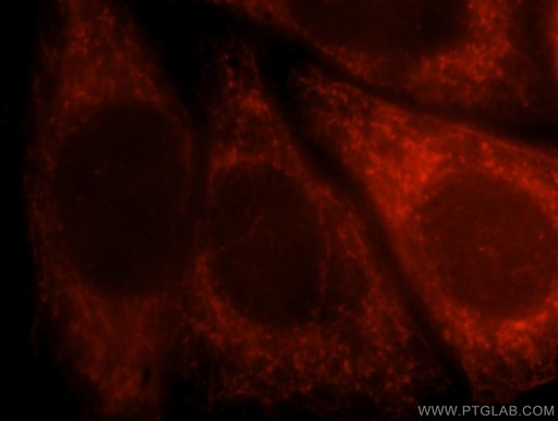 [14631-1-AP-20UL] AFG3L2 Polyclonal antibody