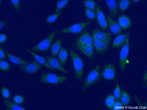 [14632-1-AP-20UL] DDX6 Polyclonal antibody