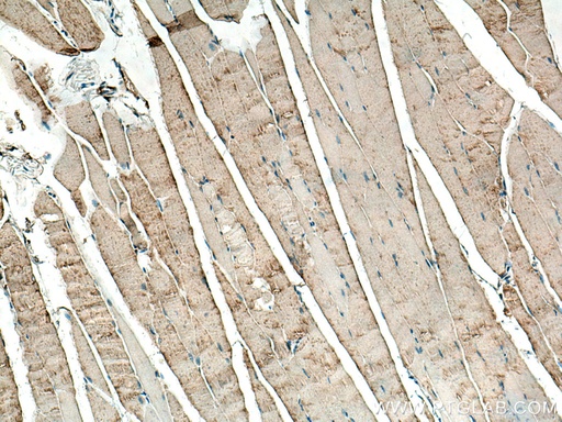 [14647-1-AP-20UL] BIN1 Polyclonal antibody