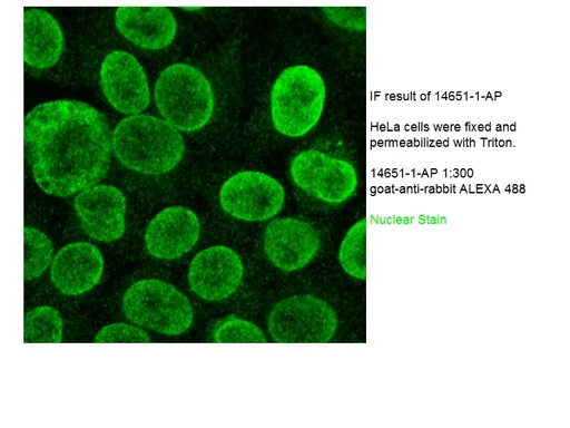 [14651-1-AP-150UL] TMPO/LAP2 Polyclonal antibody