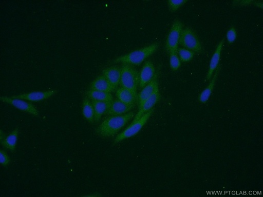 [14654-1-AP-20UL] EIF1AX Polyclonal antibody