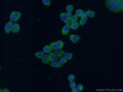 [14667-1-AP-20UL] Decorin Polyclonal antibody