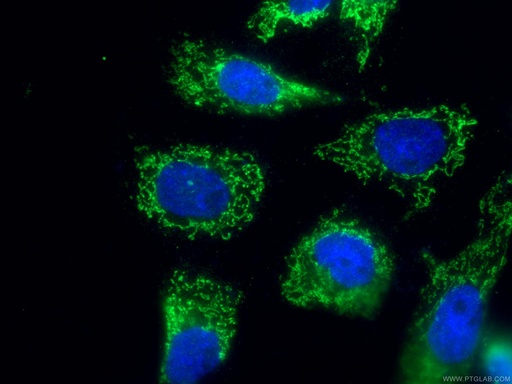 [14669-1-AP-150UL] SLC25A24 Polyclonal antibody