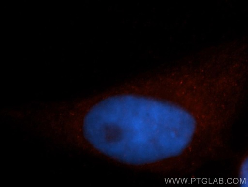 [14672-1-AP-150UL] SEPT11 Polyclonal antibody