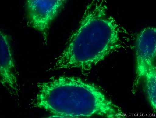 [14676-1-AP-20UL] ATP5A1 Polyclonal antibody