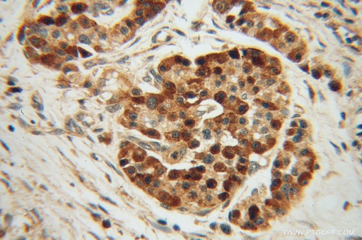 [14679-1-AP-20UL] ZADH2 Polyclonal antibody