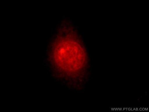 [14682-1-AP-20UL] MTA3 Polyclonal antibody