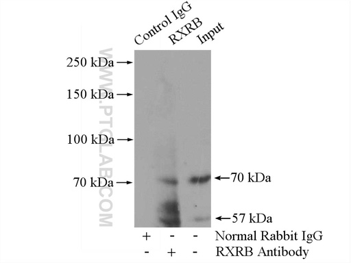 [14684-1-AP-150UL] RXRB Polyclonal antibody