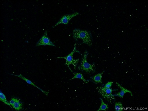 [14686-1-AP-150UL] CRMP2 Polyclonal antibody