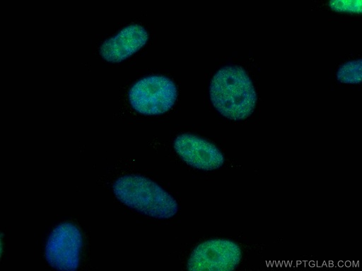 [14689-1-AP-20UL] DIS3 Polyclonal antibody