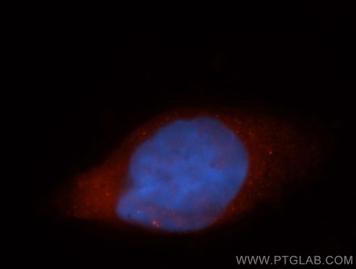 [14690-1-AP-20UL] AGAP2 Polyclonal antibody