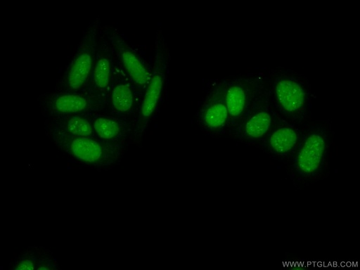 [14708-1-AP-20UL] PAPSS1 Polyclonal antibody