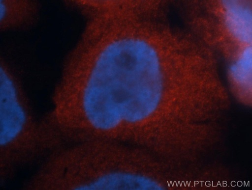 [14725-1-AP-150UL] AHSA1 Polyclonal antibody