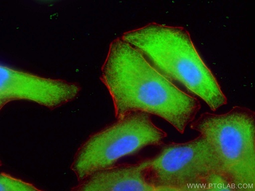 [14730-1-AP-20UL] UCHL1/PGP9.5 Polyclonal antibody