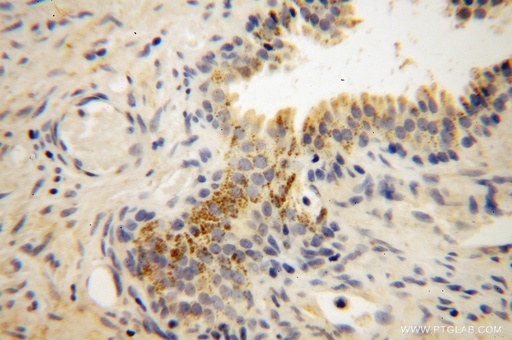 [14735-1-AP-150UL] Muskelin Polyclonal antibody