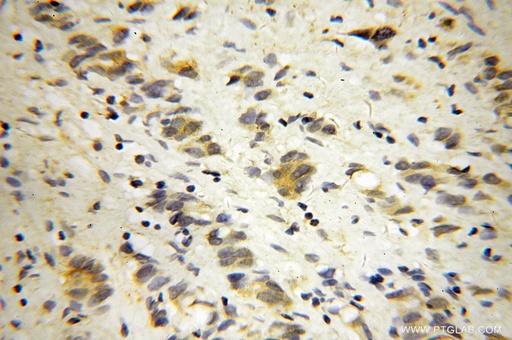 [14737-1-AP-20UL] DNM3 Polyclonal antibody