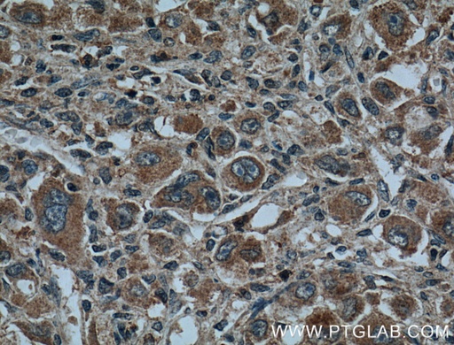 [14739-1-AP-20UL] CYP27A1 Polyclonal antibody