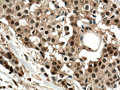 [14748-1-AP-20UL] PSMD2 Polyclonal antibody