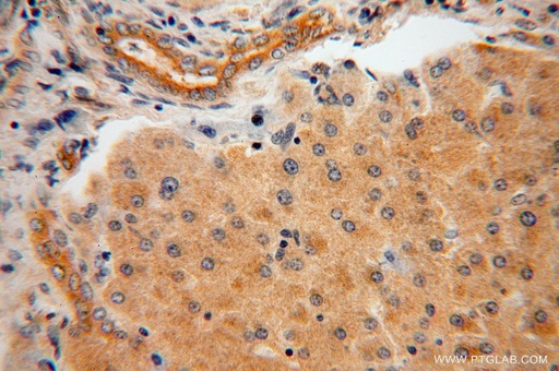 [14758-1-AP-150UL] AARE Polyclonal antibody