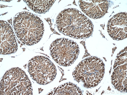 [14761-1-AP-150UL] WRAP53 Polyclonal antibody