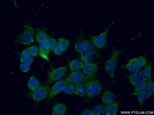 [14776-1-AP-20UL] SEC22B Polyclonal antibody