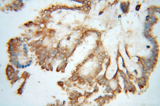 [14778-1-AP-150UL] AIFM3 Polyclonal antibody