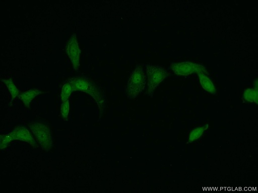 [14786-1-AP-20UL] PSMD11 Polyclonal antibody