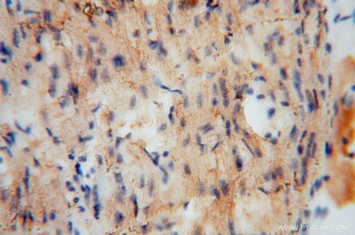 [14793-1-AP-20UL] UQCR Polyclonal antibody