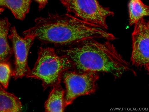 [14794-1-AP-20UL] NDUFB8 Polyclonal antibody