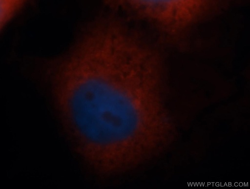 [14799-1-AP-20UL] RPS4X Polyclonal antibody