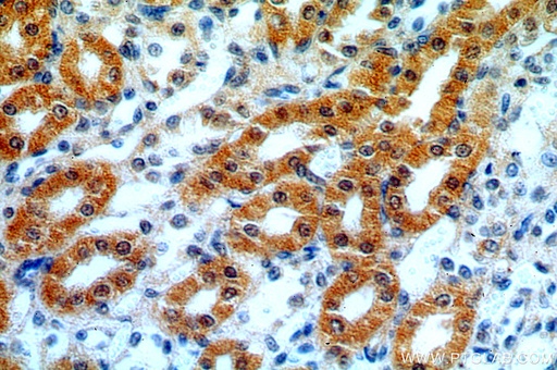 [14808-1-AP-20UL] Hikeshi Polyclonal antibody