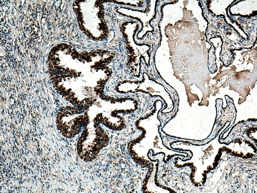 [14825-1-AP-20UL] ARG2 Polyclonal antibody