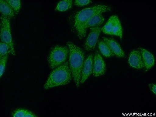 [14827-1-AP-20UL] PCYT2 Polyclonal antibody