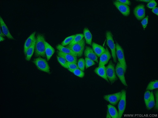 [14829-1-AP-20UL] MARS Polyclonal antibody
