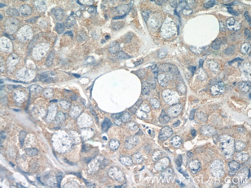 [14834-1-AP-20UL] ATF2-Specific Polyclonal antibody