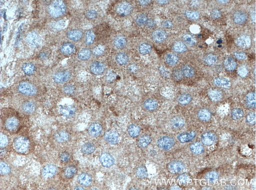 [14836-1-AP-20UL] FABP7-Specific Polyclonal antibody
