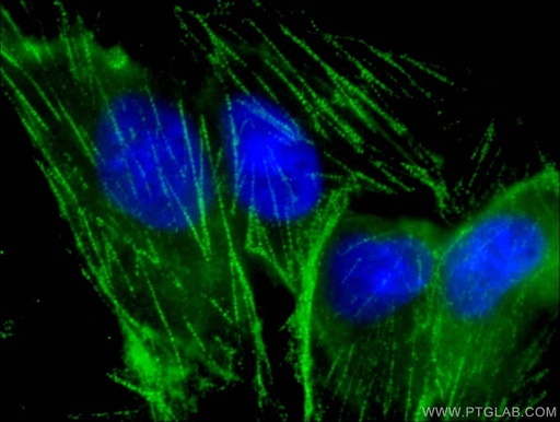 [14844-1-AP-150UL] Myh9 Polyclonal antibody